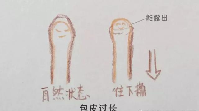 綿陽高水醫院男科專家:太敏感,時間短,試試這樣做