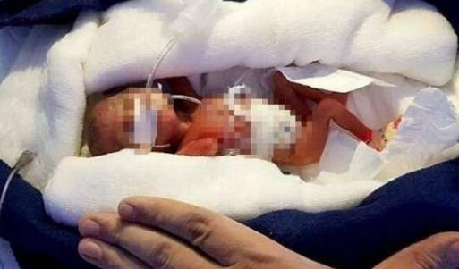 世界上最小的嬰兒.jpg
