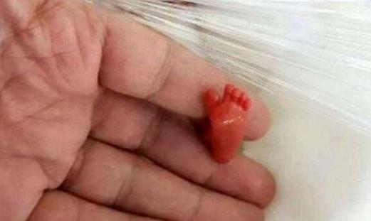 世界上最小的嬰兒2.jpg