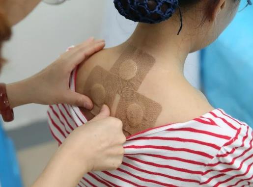 貼三伏貼有什么感覺?三伏貼中途漏了一貼有沒有效果 貼三伏貼有什么感覺?三伏貼中途漏了一貼有沒有效果