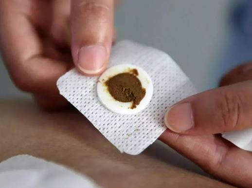 貼了三伏貼可以吃雪糕嗎?三伏貼吃了一根冰棍會失效嗎 貼了三伏貼可以吃雪糕嗎?三伏貼吃了一根冰棍會失效嗎