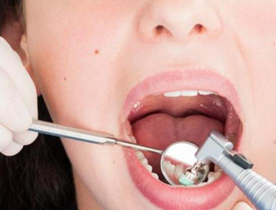 吃哪些東西容易得蛀牙?早期蛀牙能治好嗎 吃哪些東西容易得蛀牙?早期蛀牙能治好嗎
