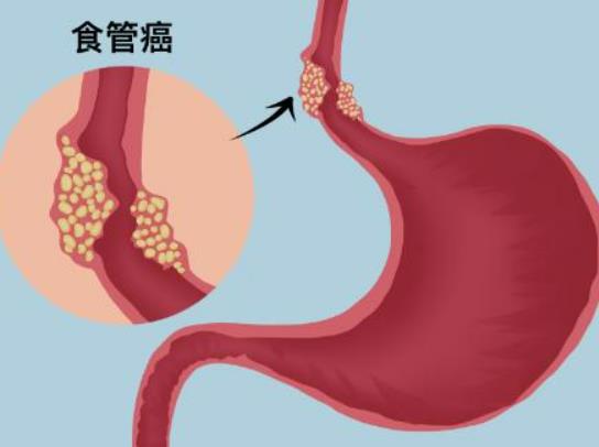 ʳ퇵ʹ᣿ʳz