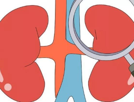 女性腎結石哪里疼?腎結石不能做什么運動 女性腎結石哪里疼?腎結石不能做什么運動