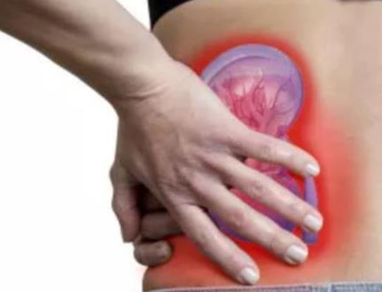 腎結石取管子痛嗎?腎結石什么時候痛 腎結石取管子痛嗎?腎結石什么時候痛